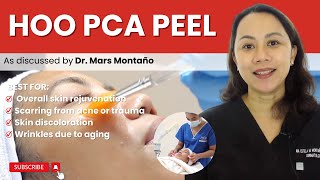 PCA SKIN PEEL [upl. by Saba]