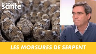 LES MORSURES DE SERPENT  BONJOUR SANTE [upl. by Onavlis552]