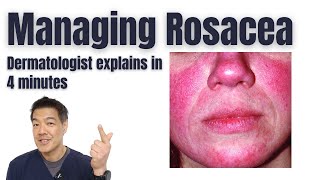 Rosacea Treatments  Tips from a dermatologist [upl. by Obnukotalo485]