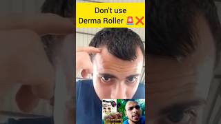 Derma Roller Hair Regrowth  How to use Derma Roller on hair dermaroller dermatology hairgrowth [upl. by Colis684]