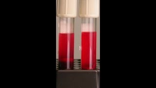 Preventing Hemolysis in the Blood Samples You Draw [upl. by Russon]