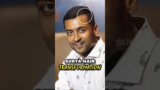 Actor Surya Hair Transplant Results  Celebrity Hair Transplant hair surya hairtransformation [upl. by Ibrek]