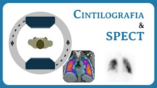 Cintilografia e SPECT [upl. by Eitra]