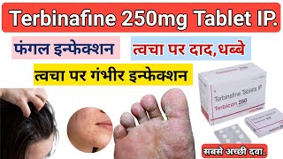 Terbinafine Tablet Use In HindiSide EffectsPrecautions [upl. by Divine]