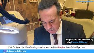 Morphea No More Pulsed Dye Laser Therapy Unveiled for Treatment morpheatreatment lasermachine [upl. by Chenay]