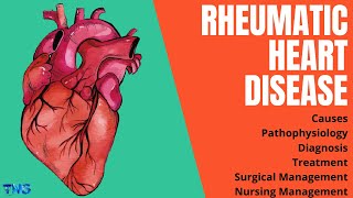 Rheumatic Heart Disease or RHD  Rheumatic Fever  Causes  Pathophysiology  The Nurses Station [upl. by Arek]