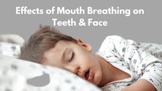 How Does Mouth Breathing leads to Crooked Teeth  Effects of Mouth Breathing on Facial Development [upl. by Wons]