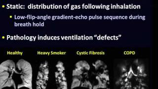 Hyperpolarizedgas MRI of the lung Can research potential translate to clinical application [upl. by Nirrad549]