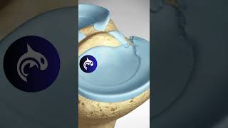 See how a Meniscus Root Repair of the Knee works  3D animation meniscus [upl. by Berg]