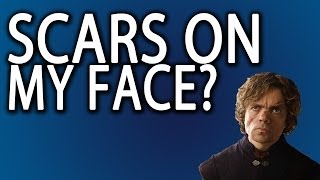 Face Scars How To Get Rid Of Scar Tissue On Your Face [upl. by Ecirrehs]