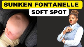 Causes and Treatment of a Sunken Fontanel and Soft Spot  Fontanelle [upl. by Dilan]