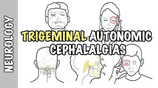 Severe headaches  Understanding Trigeminal Autonomic Cephalgias  types pathophysiology treatment [upl. by Genevra]