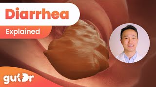 Diarrhea  Explained by Dr Vincent Ho 3D Gut Animation [upl. by Tychon]