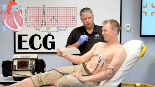 What Is ECG ElectrocardiogramEKG Indications How It Is Done And Basic Principles [upl. by Etiuqram127]