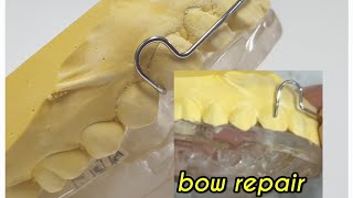 Bionator labial bow repairhow to replace a broken labial bow wire [upl. by Sirovat]