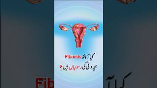 Transform Your Life The Ultimate Solution for Fibroids amp Adenomyosis [upl. by Evangelin148]