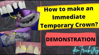 How to make an IMMEDIATE TEMPORARY CROWN Direct Temporization Technique  Demonstration [upl. by Acirret812]