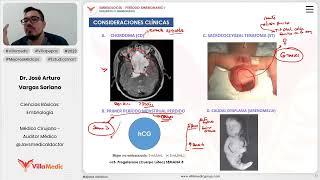 Desarrollo embrionario  Consideraciones clínicas [upl. by Desiri]