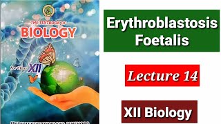 Erythroblastosis Foetalis Lecture 14 [upl. by Ohaus]