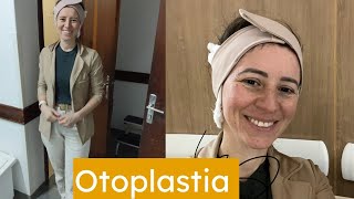 Otoplastia 7 primeiros dias de pós parte 1 [upl. by Felicidad]