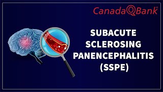 Subacute Sclerosing Panencephalitis SSPE [upl. by Einolem]