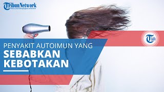 Alopecia Areata Penyakit Autoimun di Mana Sistem Kekebalan Tubuh Menyerang Selsel Sehat [upl. by Wobniar]