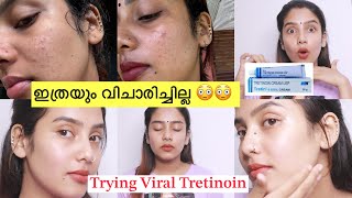 എന്നാലും നീ ആള് കൊള്ളാമല്ലോ 😳 1 Month Experience 😑Trying Viral Tretin cream 🧐 Clear Skin Rs 300 [upl. by Danice382]