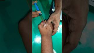 Iv injection kaise lagate hai shorts youtubeshorts drdshealthcare ivinjectionkaiselagatehai [upl. by Aimee326]