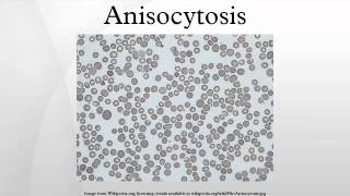 Anisocytosis [upl. by Bili]