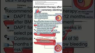 Antiplatelet therapy after coronary stenting [upl. by Tol]