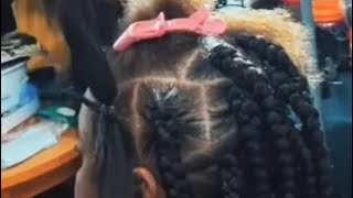 3 “NEW” Alopecia Braid Patterns amp HairstylesYou Don’t Want To Miss [upl. by Anahsit]