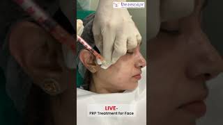 PRP Treatment For Face  shorts [upl. by Anitram]