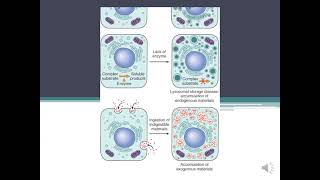 Parenchymal Stromal  Vascular Dystrophiesamp Mixed DystophiesCalcification pathology [upl. by Derna]