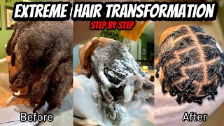 Life of a Braider Extreme Hair Transformation Combing out Matted Locs  Starter Locs  Hair Detox [upl. by Nager]