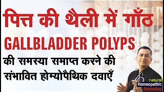 पित्त की थैली में गाँठ  Gall Bladder Polyps  Natural homeopathic remedies with symptoms [upl. by Ihskaneem255]