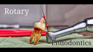 Rotary Endodontics [upl. by Odnumde]