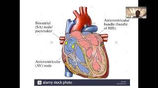 Cardiología 19 Bradiarritmias [upl. by Jobyna]