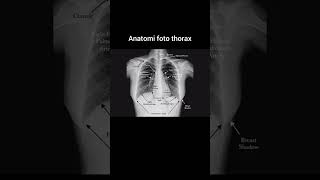 Anatomi foto thorax xray radiology anatomy chest röntgen [upl. by Nospmas69]