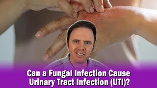 Can a Fungal Infection Cause Urinary Tract Infection UTI [upl. by Redleh]