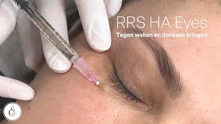 RRS HA eyes treatment l For puffy eyes amp dark cirkles [upl. by Osric944]