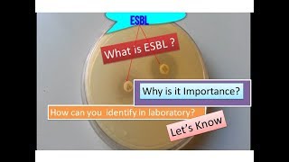 ESBL Extendedspectrum betalactamase  Escherichia coli [upl. by Burbank]