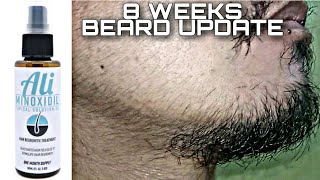 MINOXIDIL BEARD JOURNEY  WEEK 8 ASIAN BEARD 2020 [upl. by Valenba]