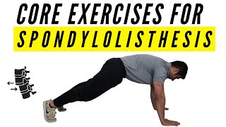 Core exercises for Spondylolisthesis [upl. by Kenward484]