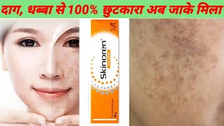 Skinoren 20 Azialic acid Cream For Acne Scars amp And Dark Spots दाग धब्बा 100 गायब 🥰 [upl. by Enorahs]