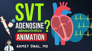 ⚡ADENOSINE ADMINISTRATION  SALINE FLUSHING  SVT TREATMENT  ANIMATION [upl. by Barny]