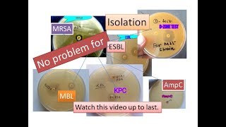 Betalactamase detectionESBL MBL KPC AmpC OxacillinaseMRSAD Zone test positive iMLSB strain [upl. by Liam]