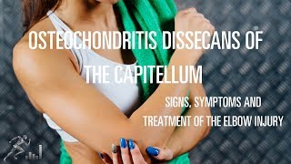 Osteochondritis dissecans OCD of the capitellum Signs symptoms and treatment options [upl. by Farlay]