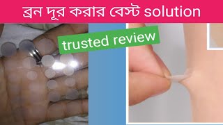 focallure acne patch review bangla  ব্রনের দাগ ফরসা হওয়ার উপায় cream body lotion review [upl. by Jay]