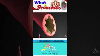 What is Bronchitis I Causes Of Bronchitis I Gaseous Exchange I Biology [upl. by Aimak]