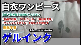 ゲルインク 染み抜き クリーニング 【 白衣ワンピース に付着したゲルインクの染み抜き ボールペンを入れたまま洗濯 」 染み抜き クリーニング せんたく屋太郎 [upl. by Basir]